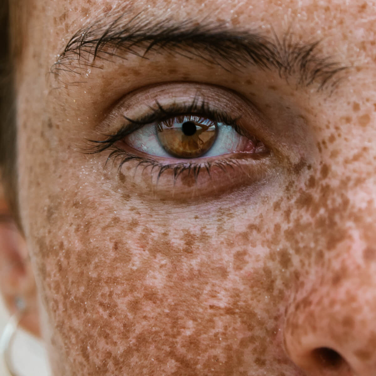 The Impact of Stress and Burnout on the Body: A Functional Medicine Approach